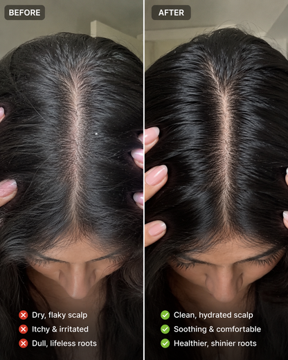 Vonflux Stimulating Hair & Scalp Balm